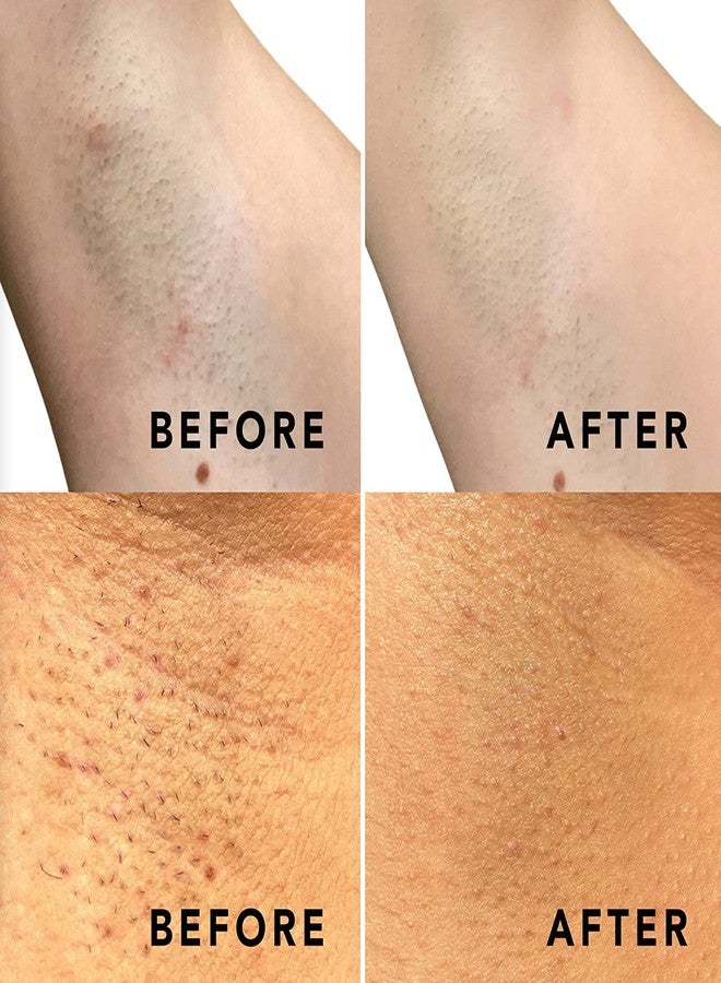 SweetSpot Labs Buff & Brighten [2 Pack] Daily Ingrown Hair Treatment with Salicylic Acid and Niacinamide, Safe for Bikini Area, Exfoliating & Brightening Pads - Image 3